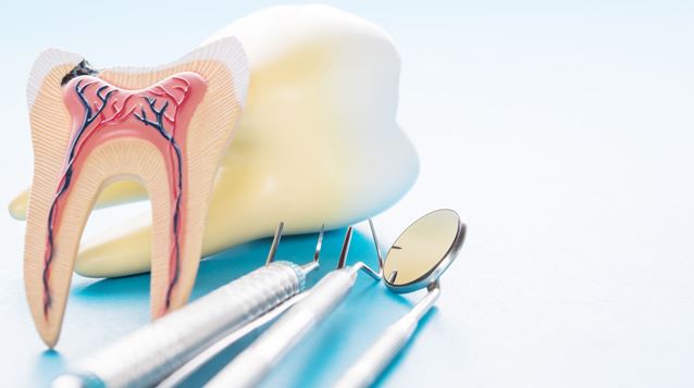 How Can a Tooth Be Saved with a Root Canal?