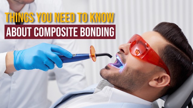 Things you need to know about Composite Bonding