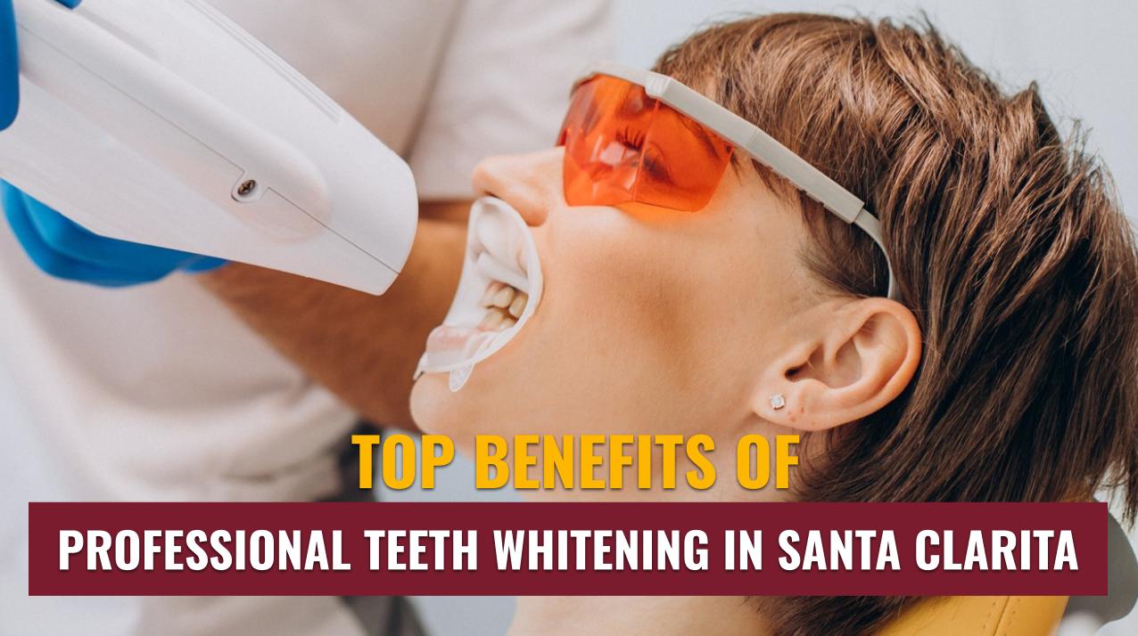 Brighten Your Smile with Confidence —  Top Benefits of Professional Teeth Whitening in Santa Clarita