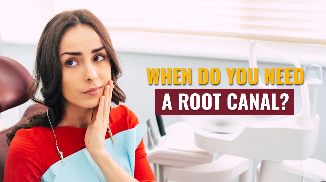 When do you need a Root Canal