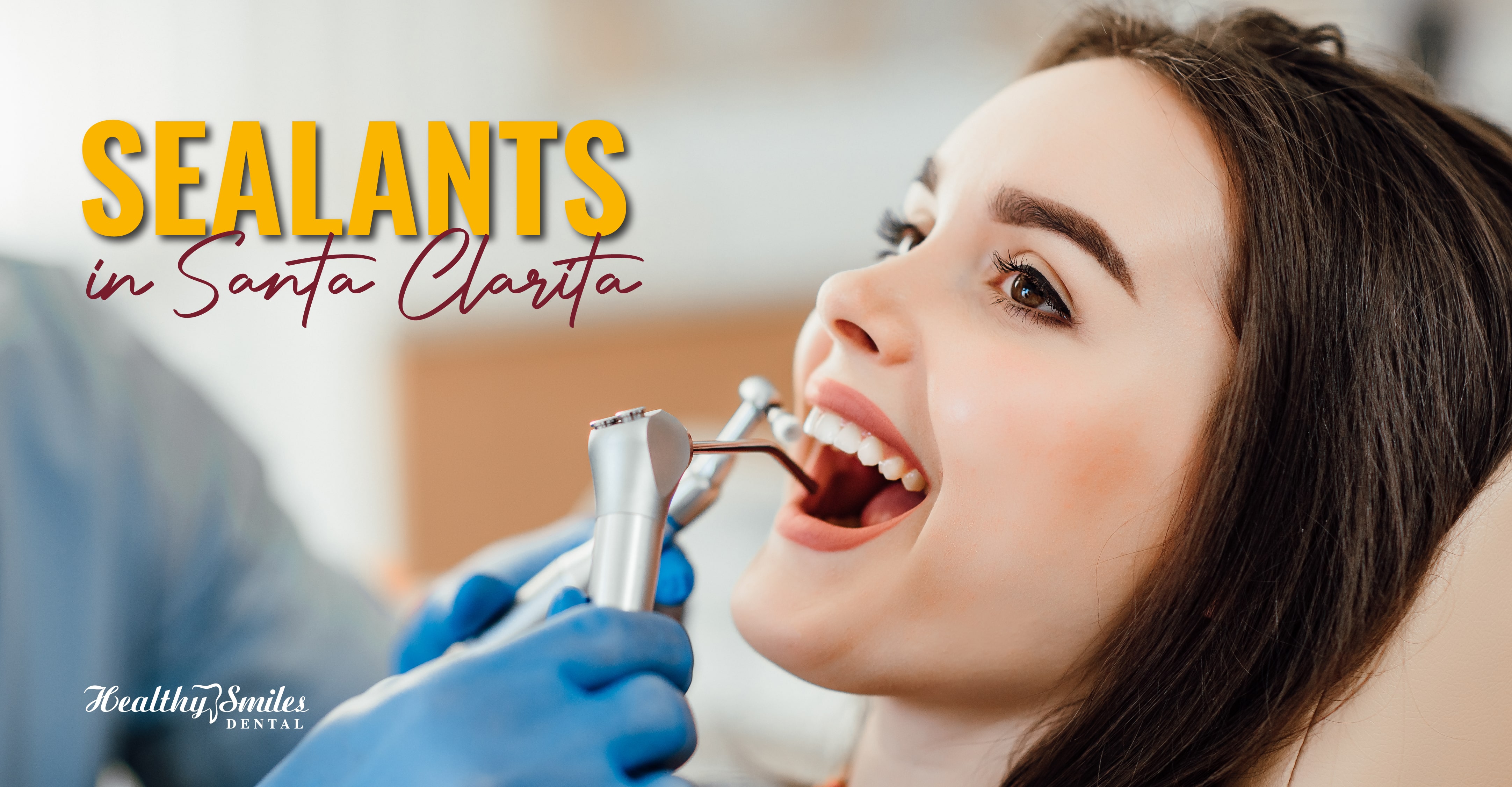 Sealants Prevent Cavities