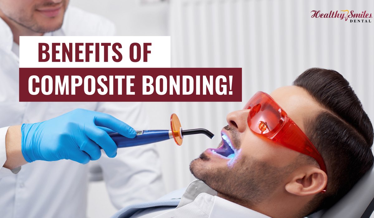 Things you need to know about Composite Bonding
